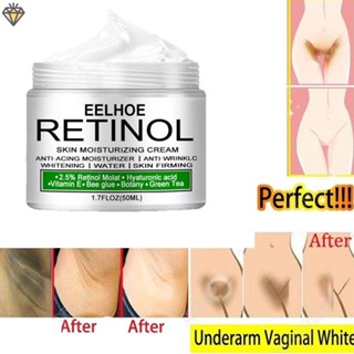 Creme Branqueadora Para Axilas Do Joelho Removedor Privada/Pigmentação/Melanina Melhora/Cuidados Com A Pele Hidratante YIYUE