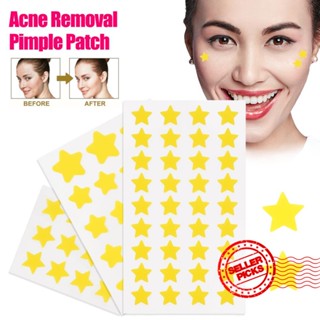 Mini Star Butterfly Removedor De Acne Invisível De Borboleta Patch De Beleza Mancha J8A0