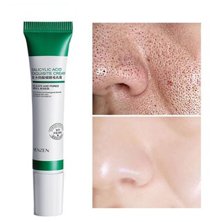 Creme De Ácido Salcyclic 20ml Para Remoção De Poros/Acne & Clareamento/Anti-Ássidade