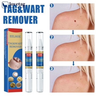 LOVETAG Removedor De Verruga Caneta Líquido Verrugas Sem Dor Papillomas Tratamento Plano Antibacteriano Da Pele À Base De Ervas I4M5