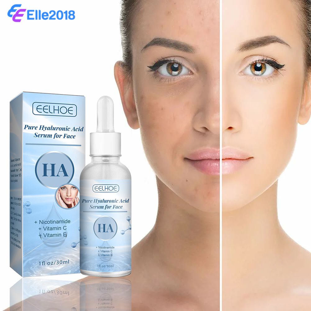 Luxuoso brilho, antirrugas, reparação, aumento da produção de colágeno, suavidade, hidratante facial natural, hidratação, ácido hialurônico, soros, rejuvenescimento da pele, elasticidade [Melhor preço Compre agora]