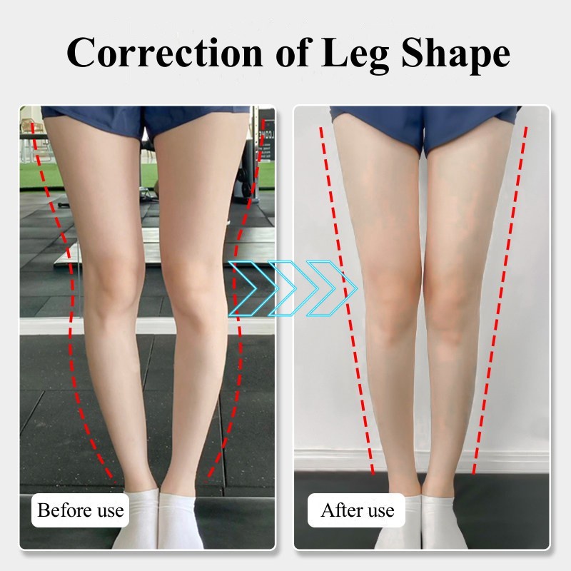 Palmilhas Ortopédicas De Silicone Para Pés Tipo O/X Perna Valgus Varus Correção Plantar Fasciitis Gel Palmilha Massagem Magnética Cuidados Com Os