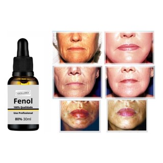 Peeling Quimico Fenol Profundo 80% + Neutralizante 30ml