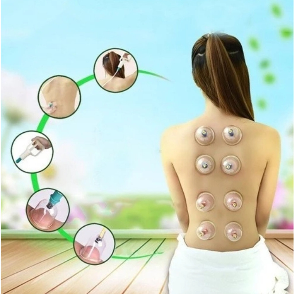 Kit com 12 Ventosas para Massagem: Ventosaterapia, Acupuntura e Massoterapia - Envio Imediato!
