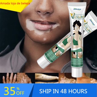 Extrato De Ervas Pomada Vitiligo Remoção De Manchas Brancas De Eliminar Creme De Tratamento Cuidados Com O Corpo