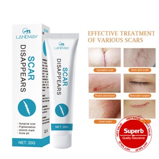 Creme De Remoção De Cicatrizes Gel Reparador Pomada Marca De Queimadura Cicatriz 20g Cuidados X2U1 em Oferta na Shopee