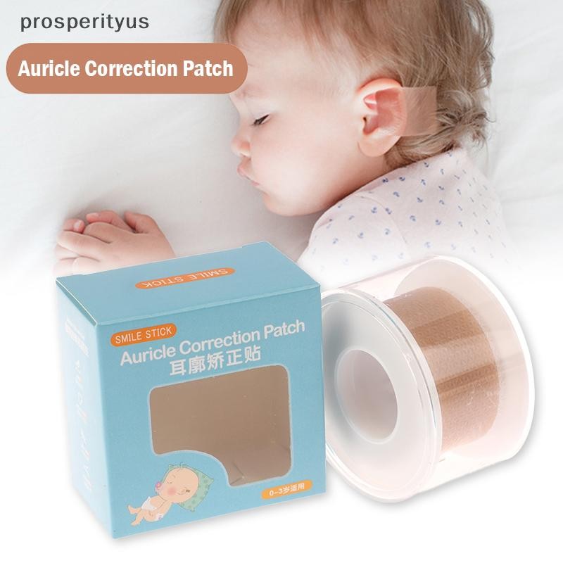 [prosperityus] Corretor De Orelha De Bebê Correção De Orelhas Salientes Infantis 5 x 100 Cm Silicone Corretores Estético em Oferta na Shopee