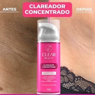 Creme Branqueador Corporal , Melasma , Acne , Axilas , Linha De Biquíni Refrescante