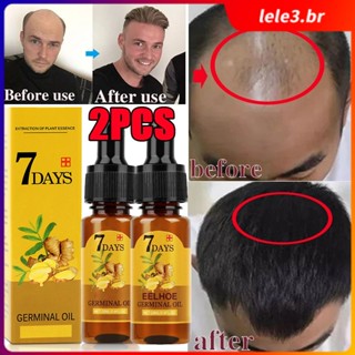 2PCS EELHOE Fluido Para Crescimento Rápido Do Cabelo Gengibre Óleo Essencial O Beleza Cuidados Com 7 Dias Prevenir A Queda De Homens Mulheres 20ml