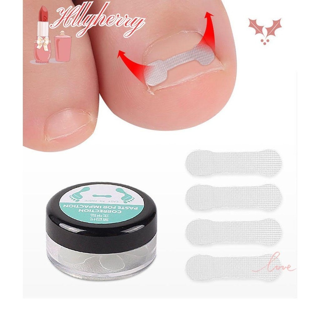 Hllylyherry 10pcs Pedicure Elástica De Unhas Do Dedo Pé Encravado DIY Adesivos De Correção