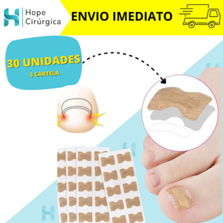 Kit 30 Adesivos Correção de Unha Encravada - contém 30 Adesivos
