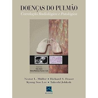 Doenças do Pulmão: Correlação Radiológica e Patológica