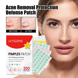 200 Remendos Estrela Espinha Remendo Acne Colorido Invisível Remoção De Cuidados Com A Pel...
