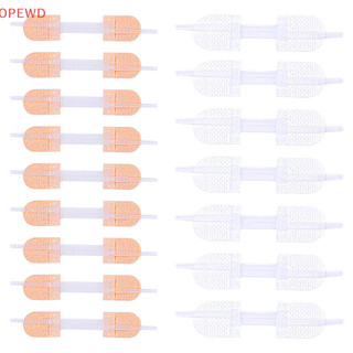 [OPEWD] Zipper Fechamento De Feridas Com Fecho Patch Hemostático De Sutura Rápida