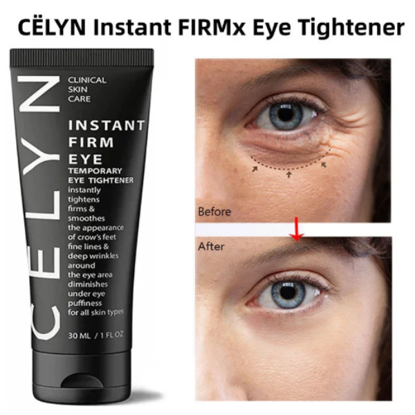 CELYN 30ml Creme De Olhos Firme Instantâneo Reduzir Linhas Finas E Círculos Escuros Ao Redor Dos Levantar A Pele Remover Bolsas Apertar Os em Oferta na Shopee