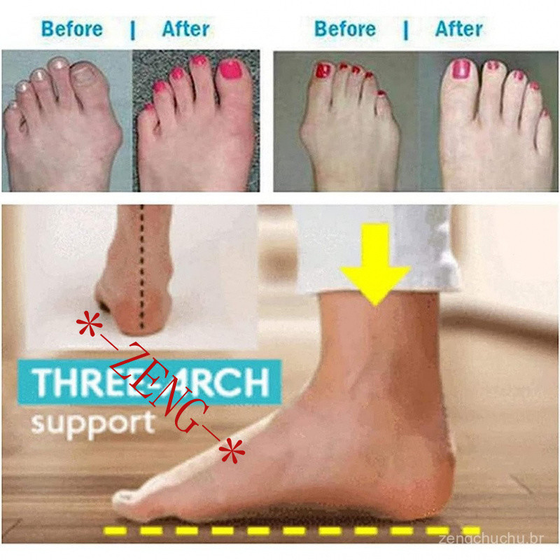 Detalhes do Sandálias Flip Flops De Verão Femininas Com Suporte Em Arco-Clip Leve E Confortável Para Caminhada  Sandália De Cunha De