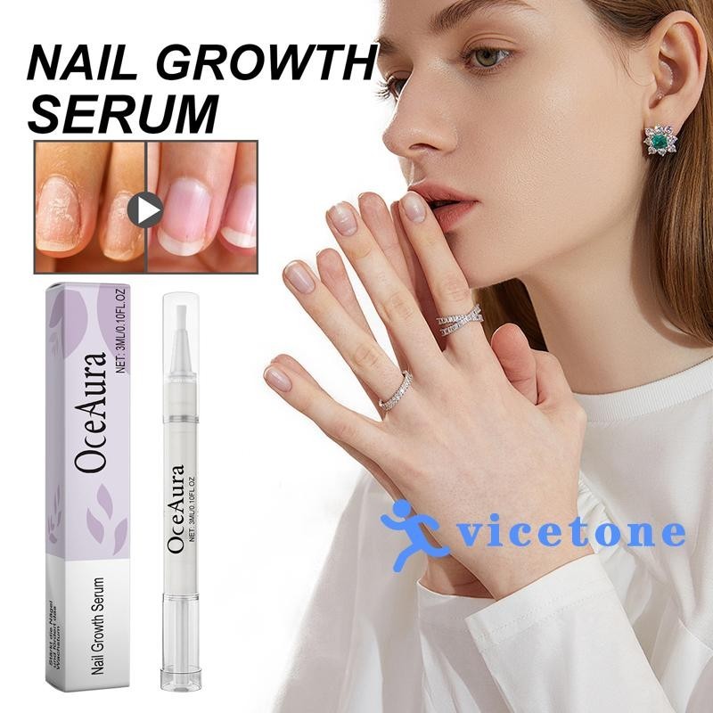 VICETONE-Cuticle Oil Pen Nail Strengthener Reparação De Unhas Líquidas Para Danificadas Ajuda A Reparar E Nutrir Rachadas