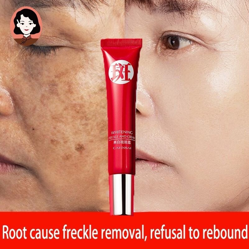 Creme original forte para remoção de manchas escuras/pigmentação clarificada/cuidados com a pele