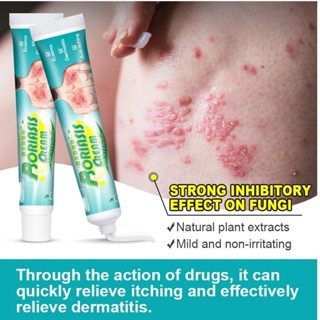 Creme Psoríase Solução Holística Alívio Eficaz Da Coceira Avançado Hidratação E Nutrição Pele cupionbr Ecossistema Saudável em Oferta na Shopee