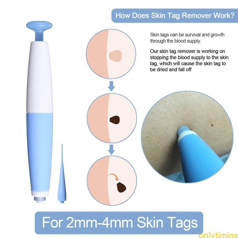 Somente Removedor Marcas Pele Para Remoção 2mm A 4mm Mole Skin em Oferta na Shopee