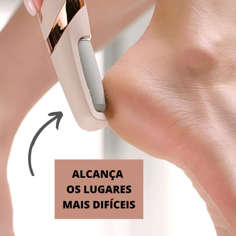 Lixador de Pé Elétrico - Esfoliador Tira Calos Pedicure Portátil Marisa Lixa Elimina Calo Portátil Usb Pilha Lolita