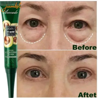 Creme Para Remoção Instantânea De Rugas Anti-Sacos Círculos Escuros Linha Fina Puffiness Fade em Oferta na Shopee