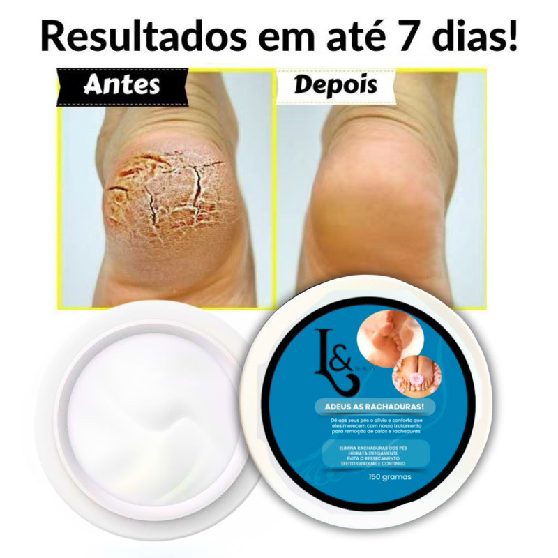 Creme Para Rachaduras Fissura Dos Pés Tratamento 150g - L&Beauty em Oferta na Shopee