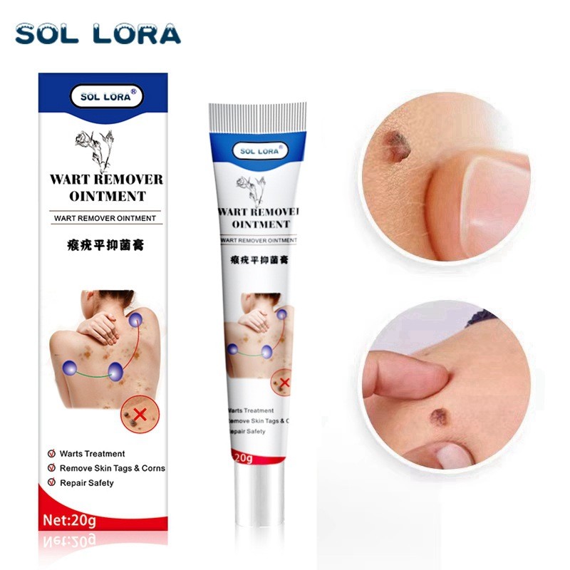 Pele uso externo verrugas em forma de seda suavizam calos