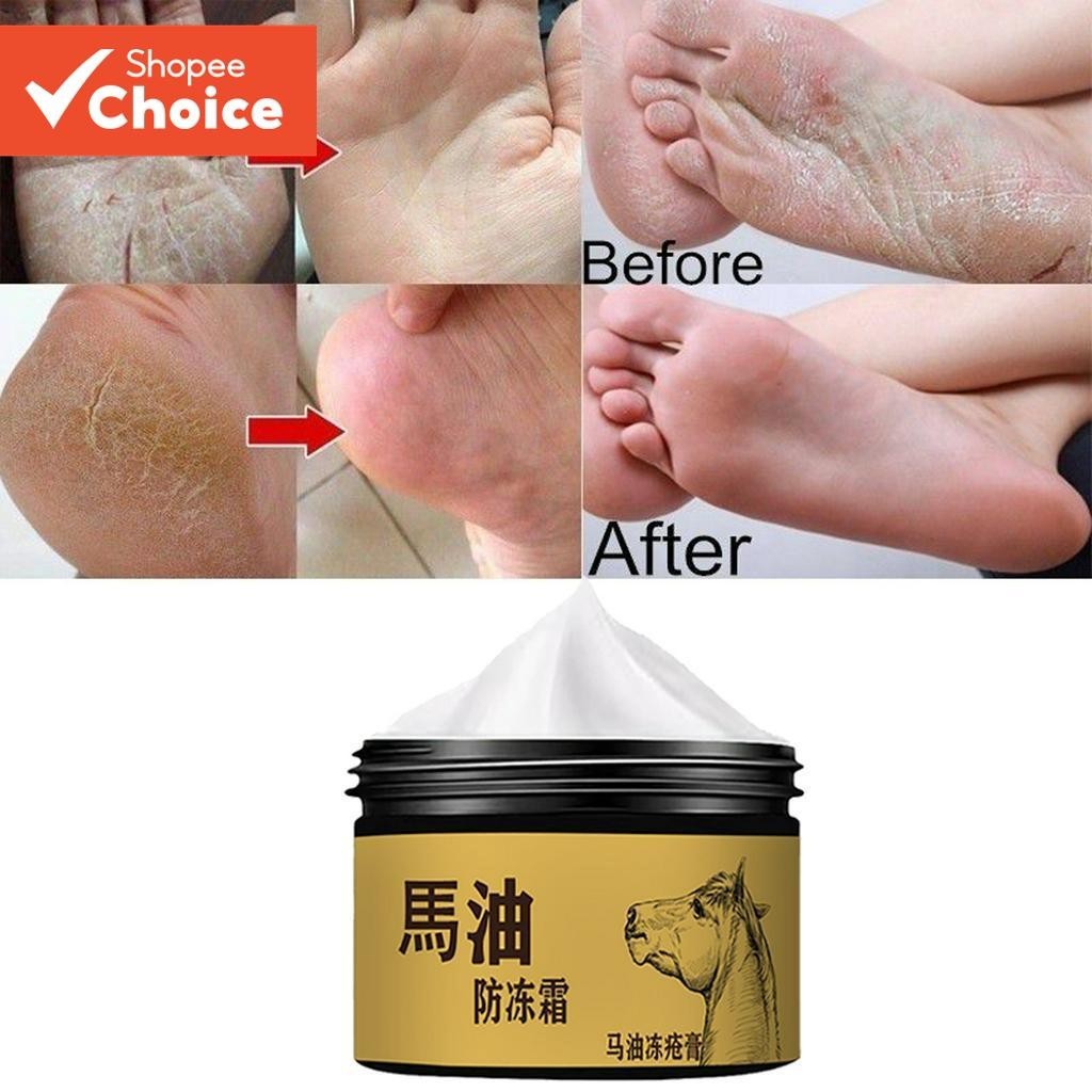 Óleos De Cavalo Creme Para Pés Anti-Rachaduras Hidratante Reparador De Pele Calcanhar