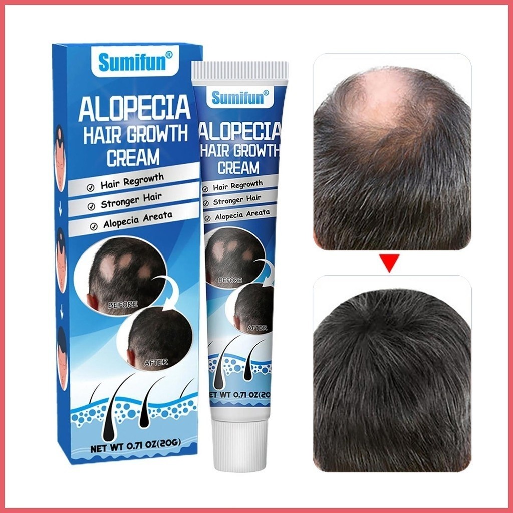 Essência De Crescimento Capilar 20G Óleo Rápido Anti-Queda Para Cabelo em Oferta na Shopee