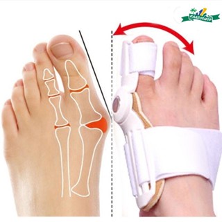 Órtese Noturna para Correção de Joanetes - Articulada e Ergonômica em Oferta na Shopee
