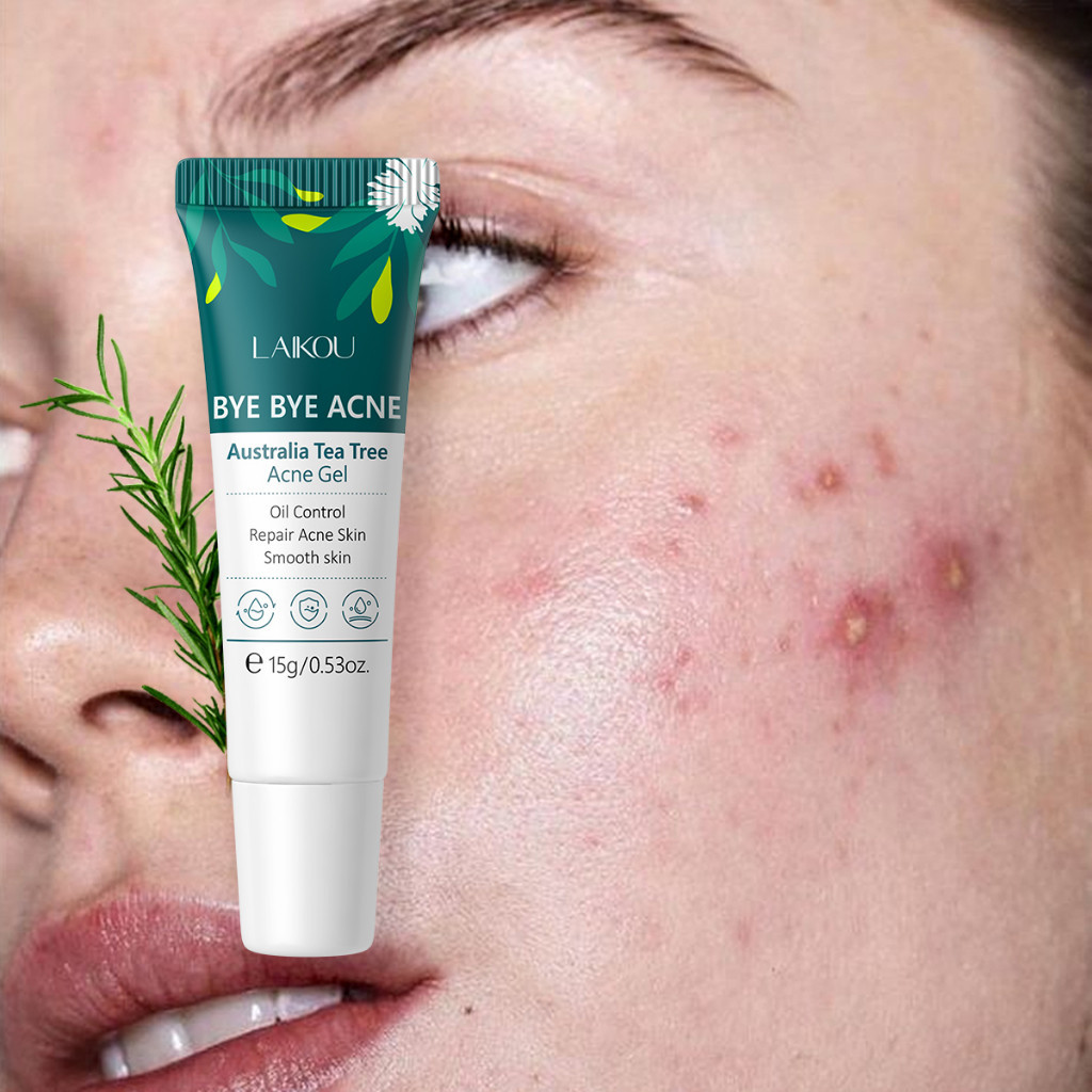 BYE Acne-LAIKOU Australia Tea Tree Gel 15g Unnclog Pores Reduzir A Facial & Acumulação Da Queratina Suavizar Reparo Pele Com