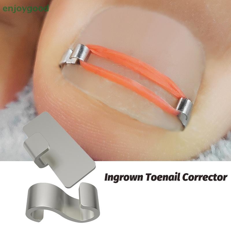 [B & H] Ferramentas Corretoras De Unhas Encravadas Pedicure Recuperar Incorporar Tratamento Ferramenta De Cuidados Com O