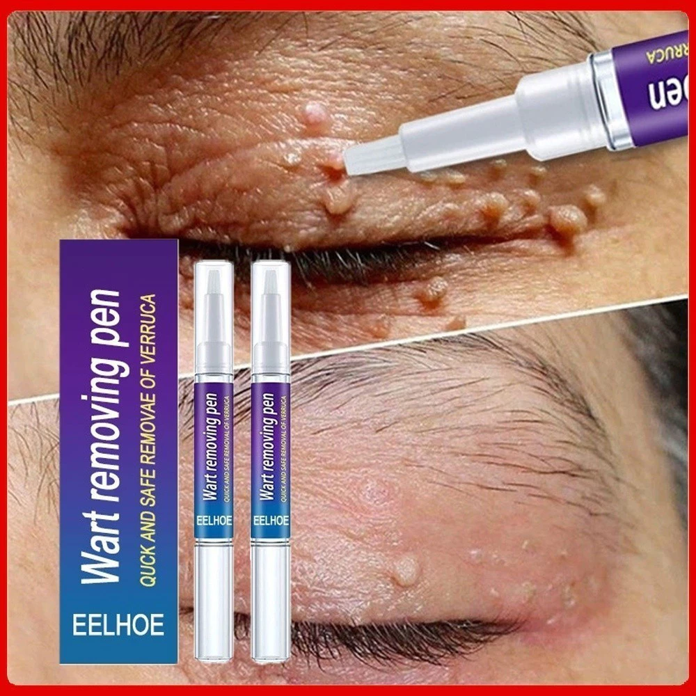 Creme Para Remoção De Partículas De Queratina , Reparo Profundo Da Pele — imagem 1