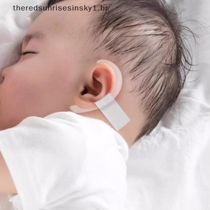 【theredsunrisesinsky1.br】 Infant Auricle Correction Patch - Protruding Ear Support .