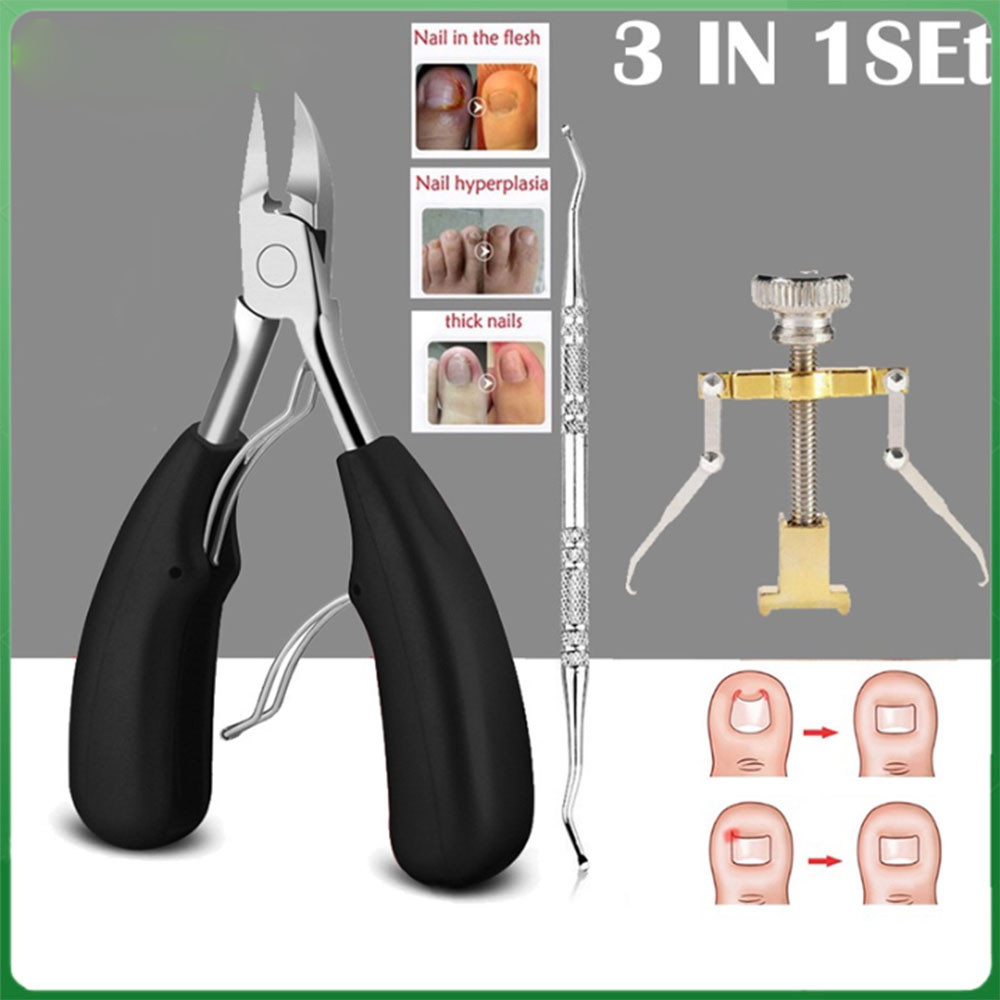 Ferramenta De Tratamento INGROWN TOENAIL 2/3PC/Set Corretor Clipper Lifter Kit De Elevador De Unhas Recone De Pedicure Aço Inoxidável