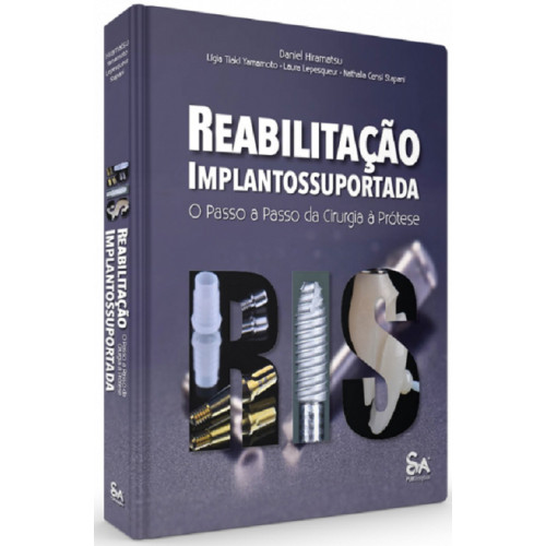 Reabilitação Implantossuportada: O Passo A Passo Da Cirurgia À Prótese - Santos Publicações