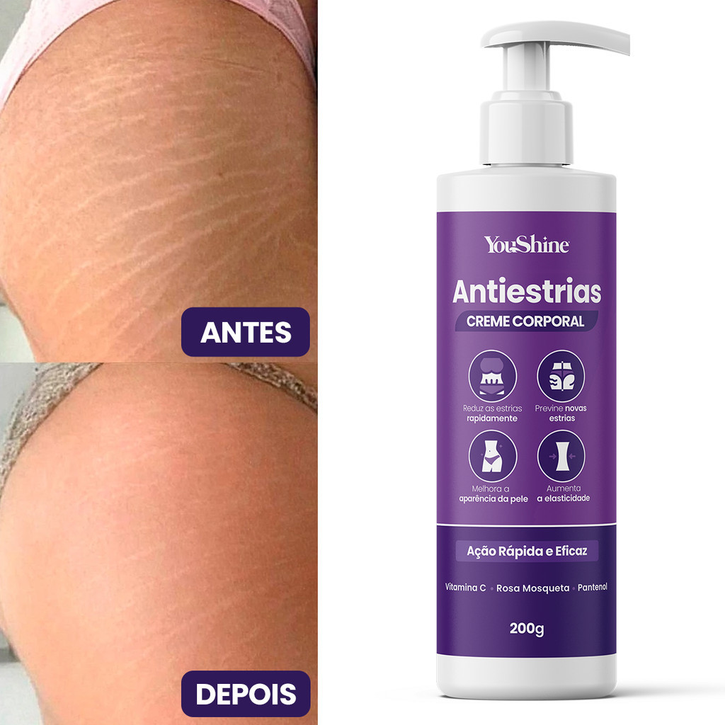 Creme AntiEstrias Removedor de Estrias e Flacidez YouShine 200g com Colágeno e Elastina Ação Rápida