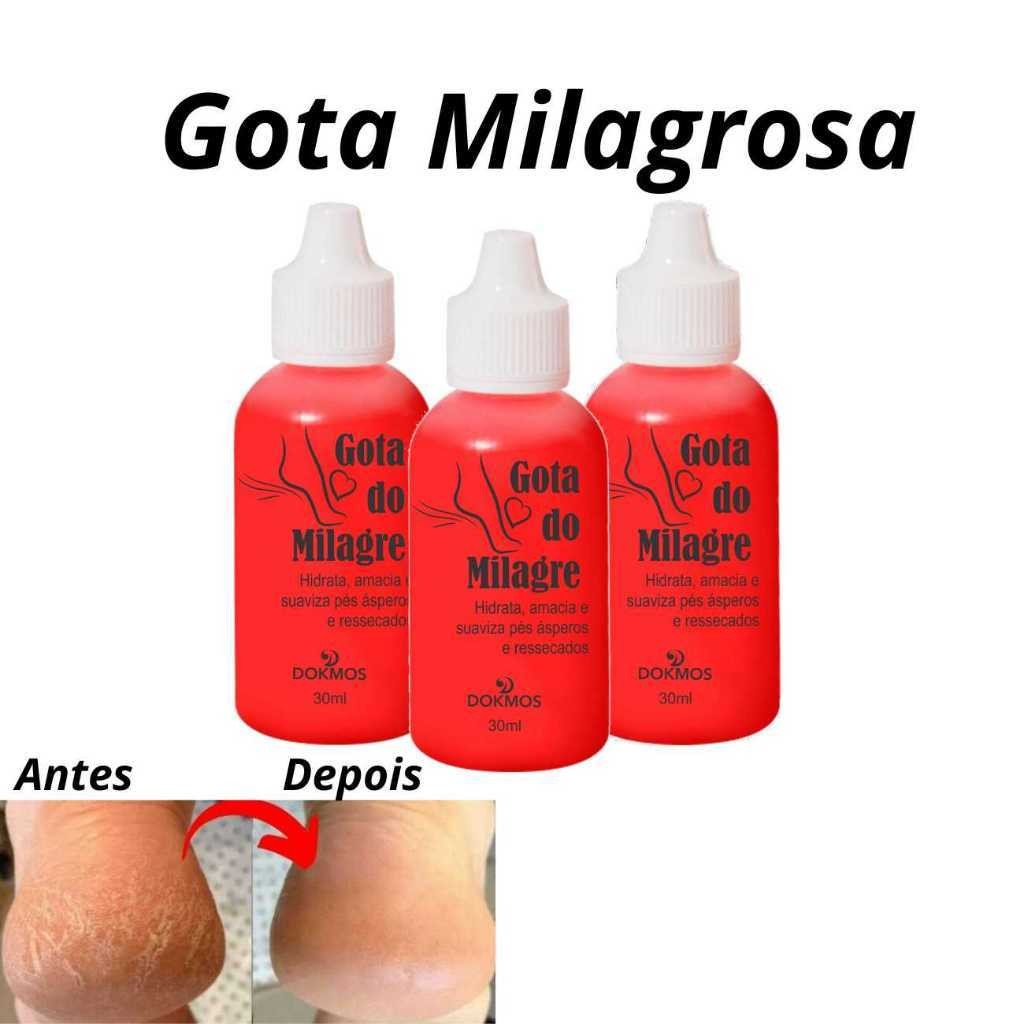 Kit 3 Gotas Do Milagre Tratamento Para Os Pés - Dokmos