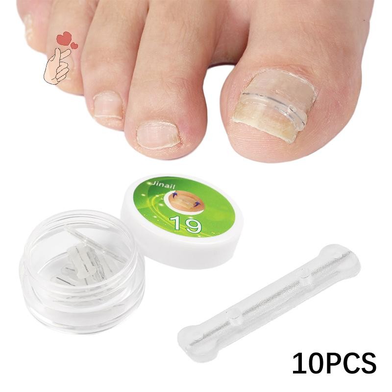 [PEBR] 10 Unidades 13-20mm Adesivos De Correção De Unhas Remendos Corretores Encravadas Tratamento De Paroníquia Correto em Oferta na Shopee