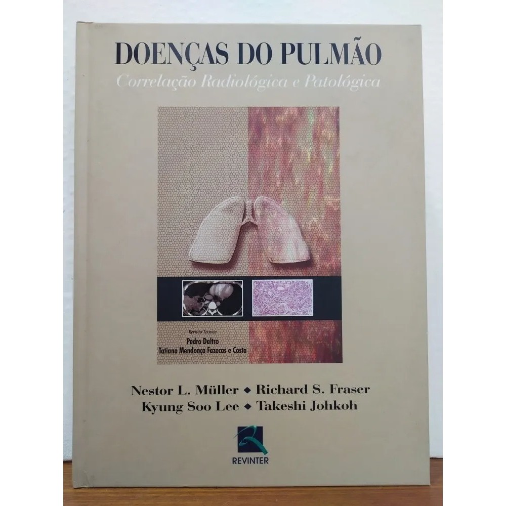 LIVRO Doenças Do Pulmão - Correlação Radiológica E Patológica