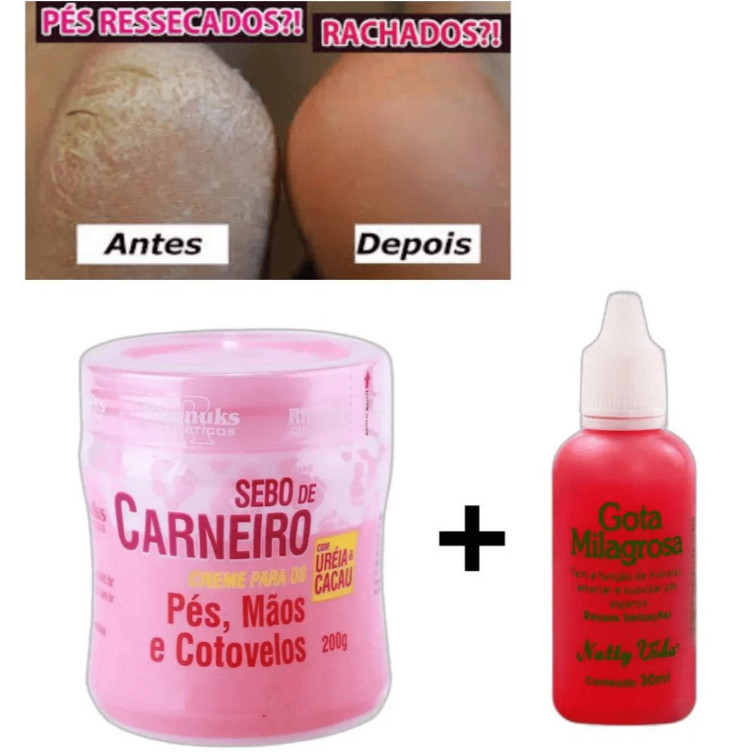 Kit para Rachadura nos Pés Gota Milagrosa + Sebo de Carneiro - Super Hidratante em Oferta na Shopee