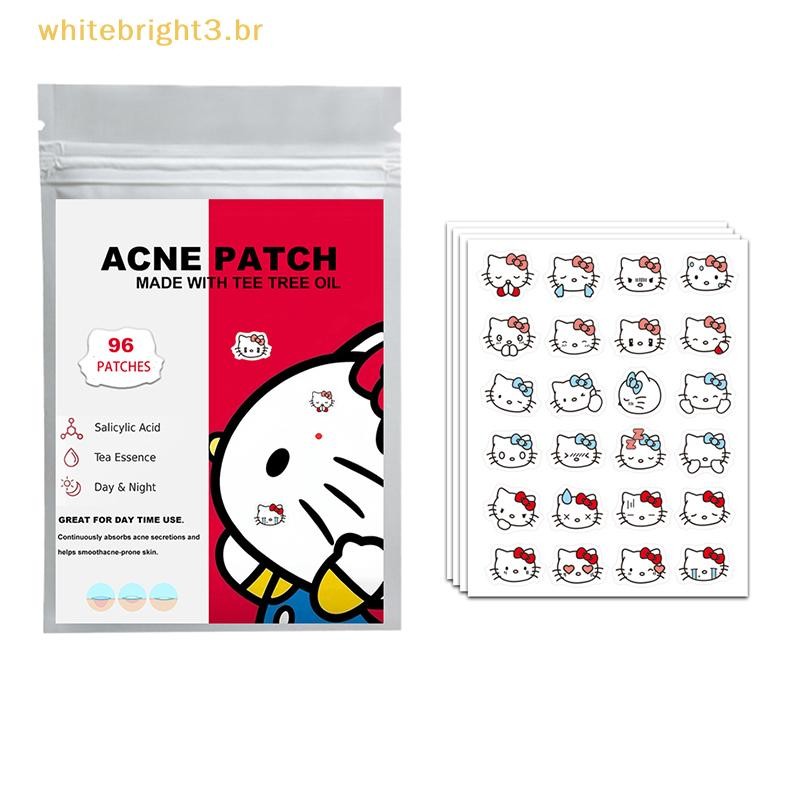 W-Beauty 96pcs Reparação Acne Remendo Cuidados Com A Pele Facial Desbotamento Manchas Espinha . em Oferta na Shopee