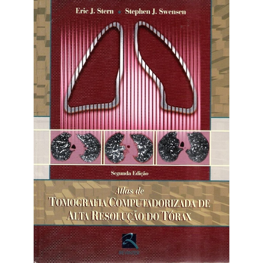 Atlas De Tomografia Computadorizada De Alta Resolução Do Tór