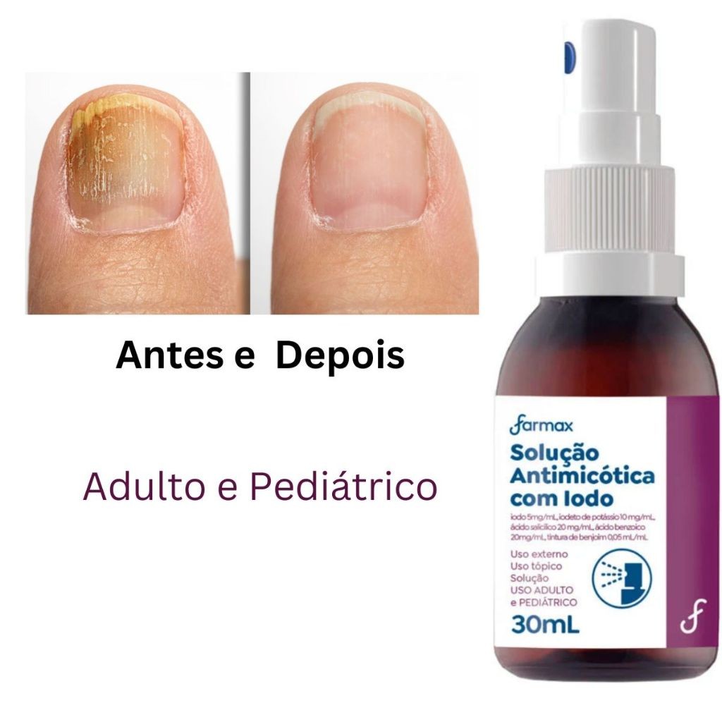 Loção Spray para Micose Farmax 30mL Iodo Unha Frieira Unheiro Amarela em Oferta na Shopee