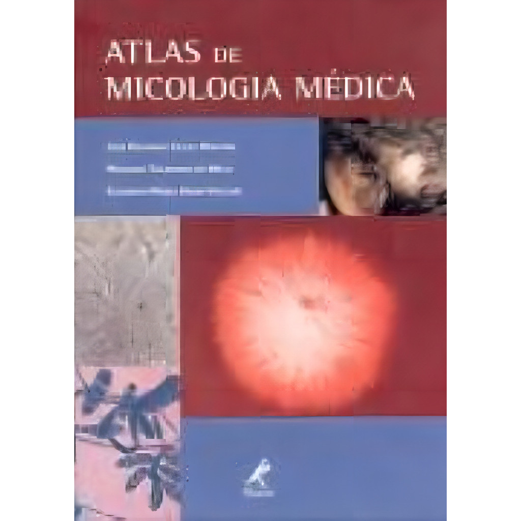Atlas De Micologia Médica, De Martins, José Eduardo Costa. Editorial Editora Manole Ltda, Capa Mole Em Português, 2004