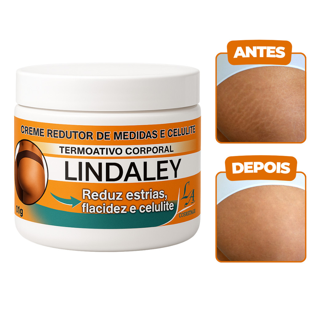 Creme AntiEstrias Removedor de Estrias 300g Lindaley