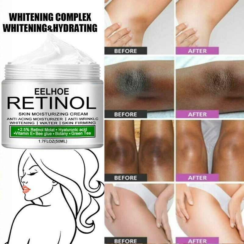 10g Creme Clareador De Corpo Inteiro Feminino Cotovelos Joelho Axilas Manchas Escuras Garganta Cuidados Com A Pele