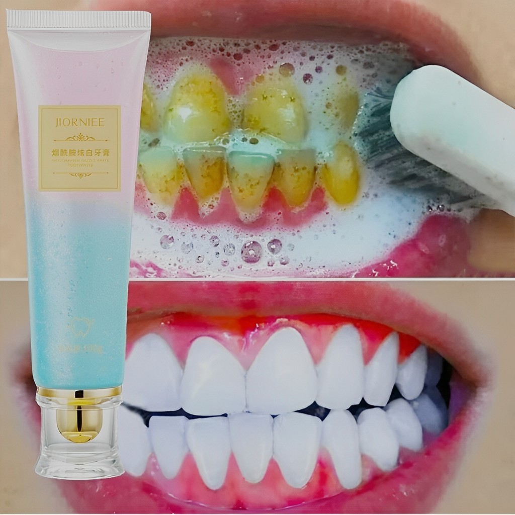 Nova Pasta de Dente Branqueadora com Niacinamida, Cuidado Fresco para Gengivas, Limpeza, C...