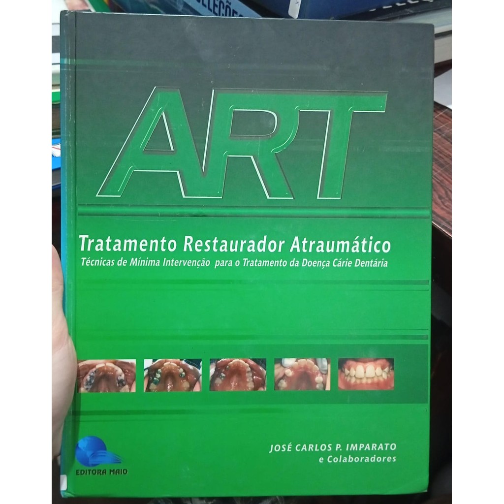 ART - Tratamento Restaurador Atraumático - Técnicas de Mínima Intervenção para o Tratamento da Doença Cár... 7347683